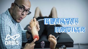 ORBIS LaB Plantar fasciitis thumbnail